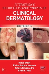 Fitzpatrick s Color Atlas and Synopsis of Clinical Dermatology, Eighth Edition